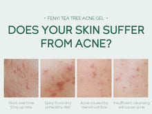 Load image into Gallery viewer, 20g Moisturizing Skin Care Products
