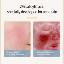 Load image into Gallery viewer, Acne Removing Salicylate Products
