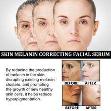 Load image into Gallery viewer, Facial Melanin Repair Hydrating Skincare Products
